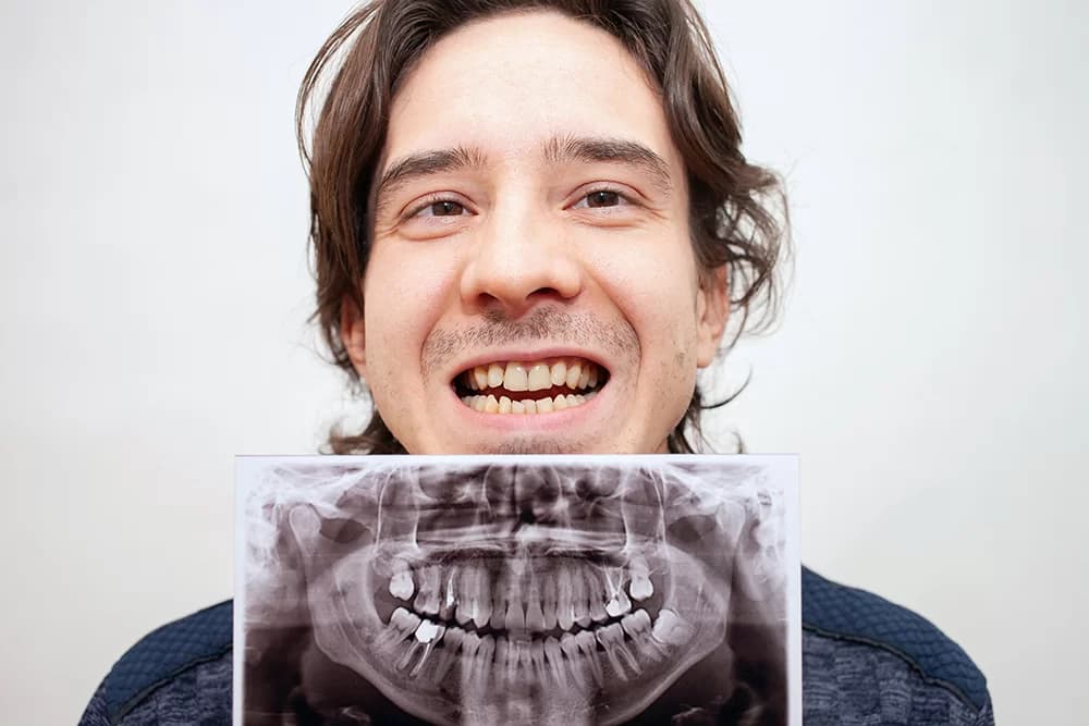Paciente con radiografía panorámica