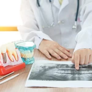 Corte 3D de implante dentario