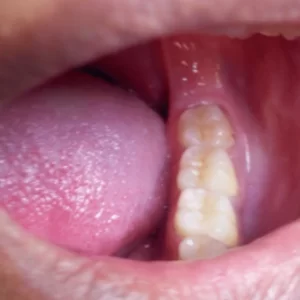 Técnico trabajando en prótesis