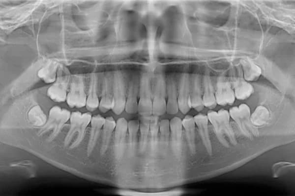 Radiografía panorámica dental